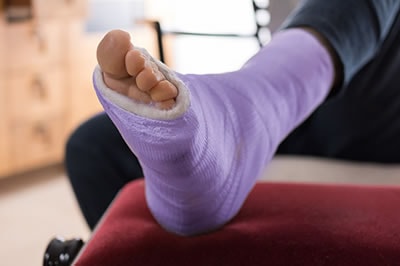 Foot and ankle fractures treatment in the Kanawha County, WV: Charleston (South Charleston, St Albans, Nitro, Pinch, Sissonville, Alum Creek, Quincy, Belle, Elkview) areas
